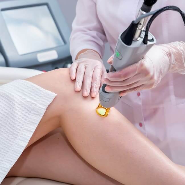 laser-hair-removal
